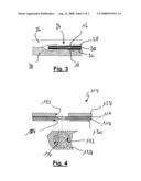 Foil-Type Pressure Sensor Adapted For Minimizing Critical Preload Issues diagram and image