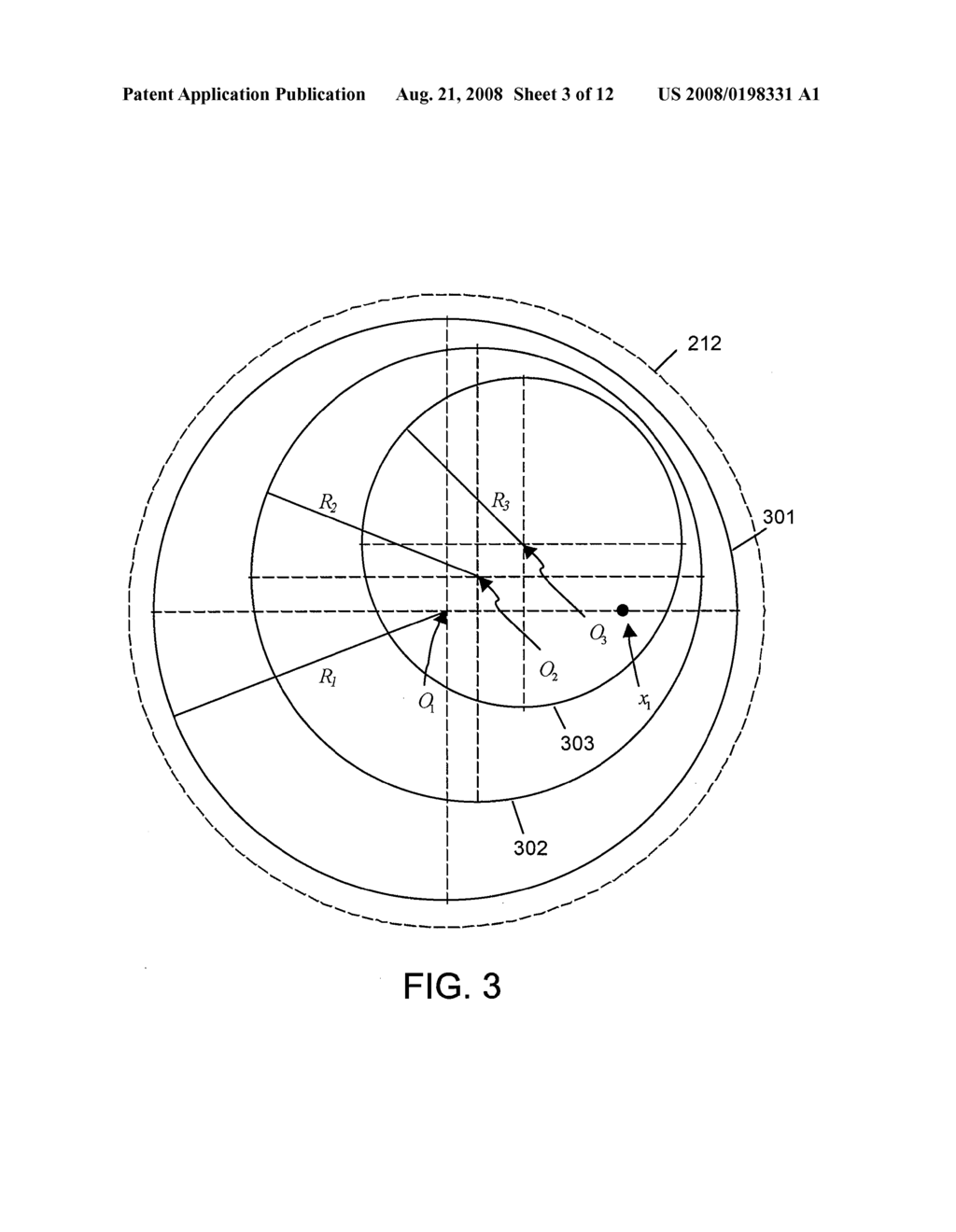 OCULAR WAVEFRONT-CORRECTION PROFILING - diagram, schematic, and image 04