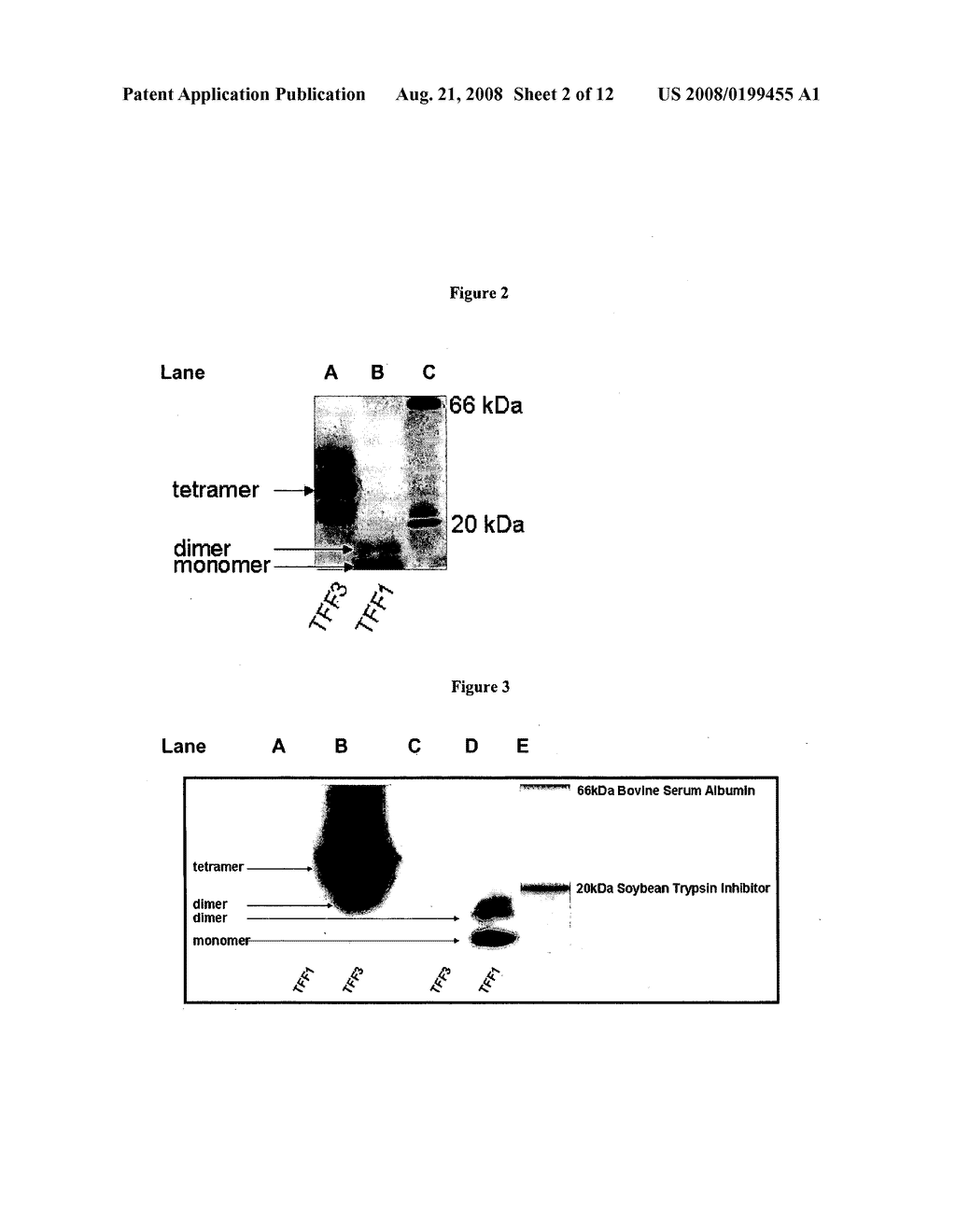 Conformation specific antibodies that bind trefoil factors and methods of treating cancers and proliferation disorders using same - diagram, schematic, and image 03