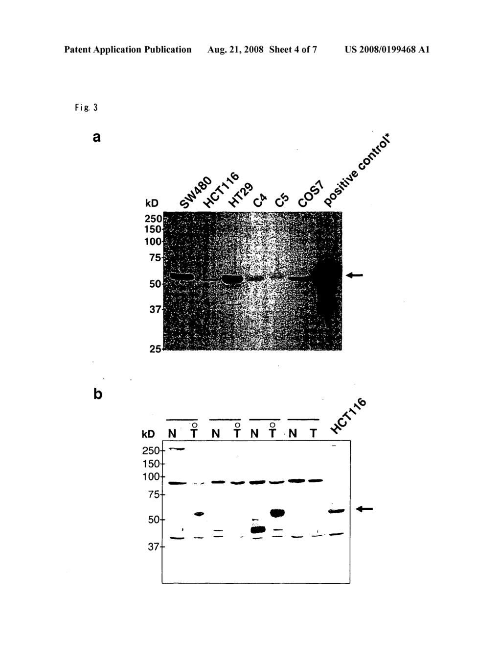 Method For Diagnosing Colorectal Cancers - diagram, schematic, and image 05