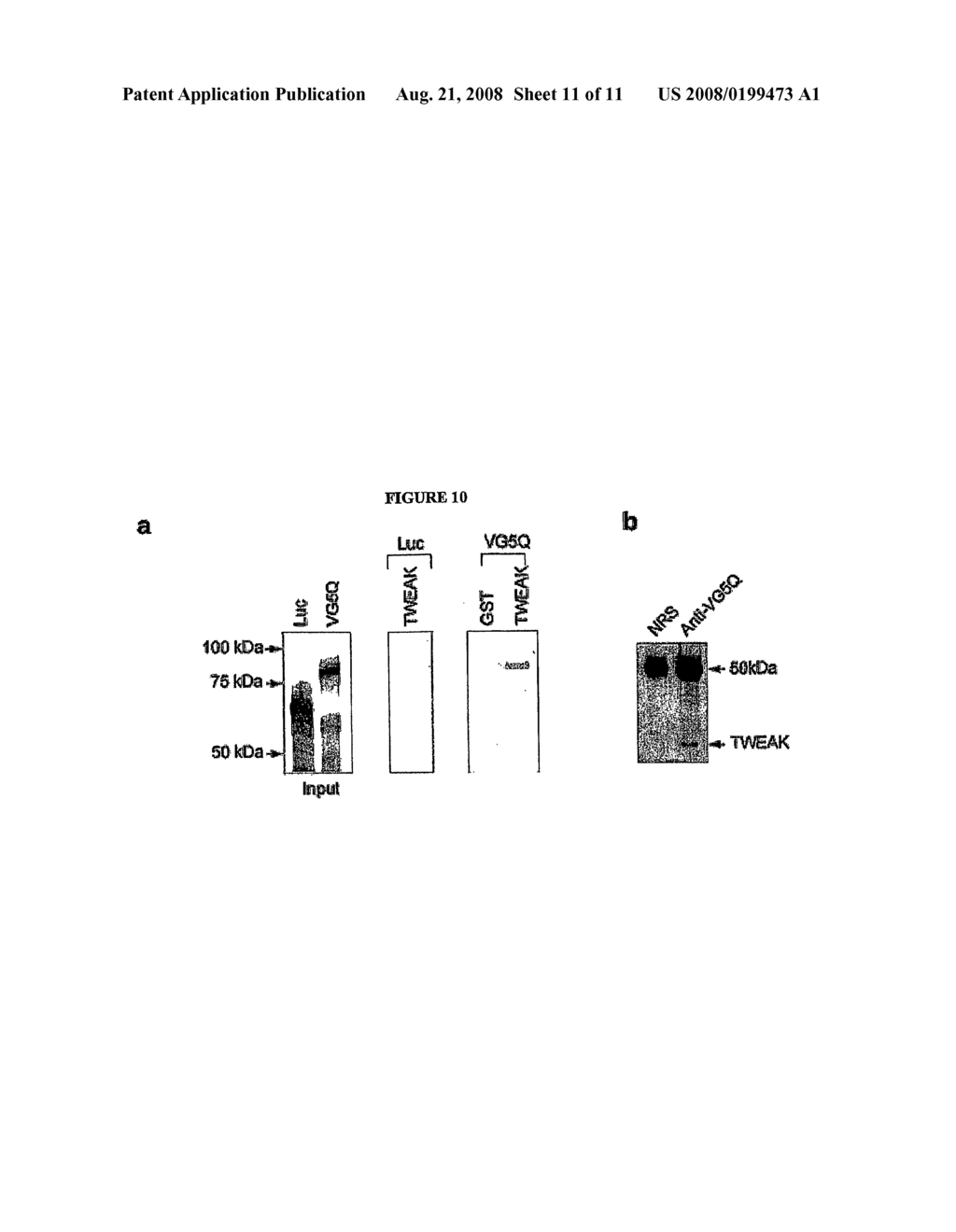 Novel Gene and Protein Associated With Angiogenesis and Endothelial Cell-Specific Apoptosis - diagram, schematic, and image 12