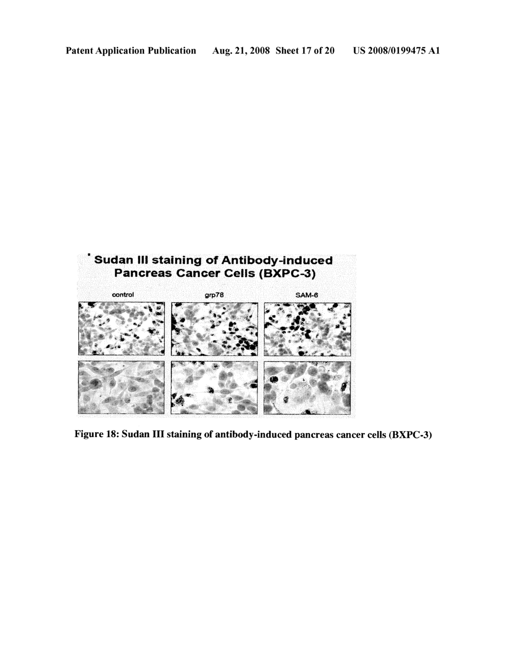 NOVEL GLYCOSYLATED PEPTIDE TARGET IN NEOPLASTIC CELLS - diagram, schematic, and image 18