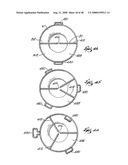 SYSTEMS AND METHODS FOR PREPARING AUTOLOGOUS FIBRIN GLUE diagram and image