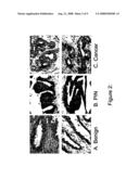 Annexin for Cancer Risk Assessment diagram and image