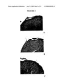 Compounds for Treating Neurologic Diseases, Otologic Diseases, or Ophthalmologic Diseases and Methods of Use Thereof diagram and image