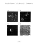 HCaRG, A Novel Calcium-Regulated Gene diagram and image