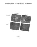 HCaRG, A Novel Calcium-Regulated Gene diagram and image