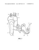 Implant Sensor and Control diagram and image