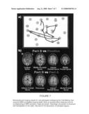 Method and system for computerized drawing and writing during functional magnetic resonance imaging diagram and image