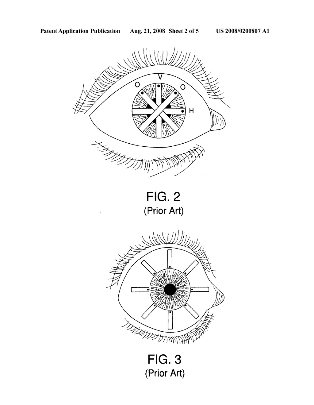 Attitude-sensing ultrasound probe - diagram, schematic, and image 03