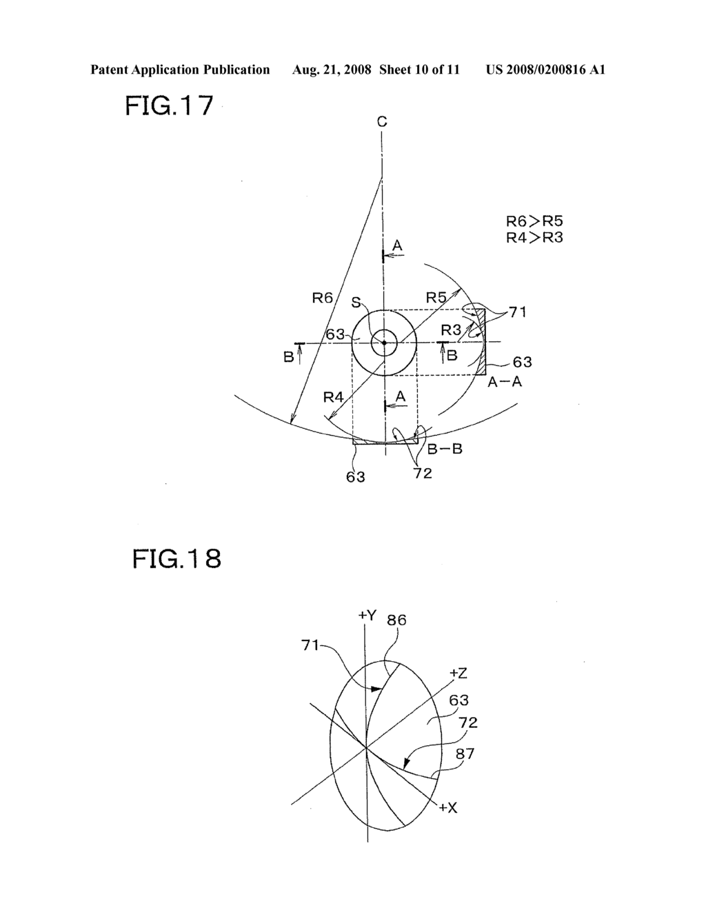 ULTRASOUND DIAGNOSTIC APPARATUS, ENDOSCOPE AND ULTRASOUND TRANSDUCER - diagram, schematic, and image 11