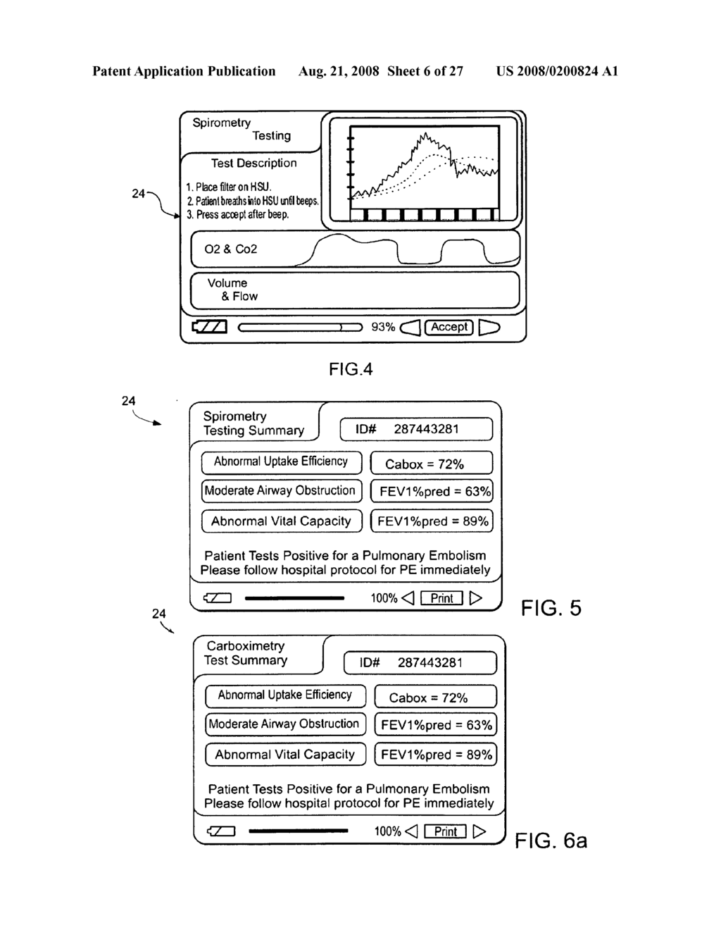 Devices, systems, and methods for aiding in the detection of a physiological abnormality - diagram, schematic, and image 07