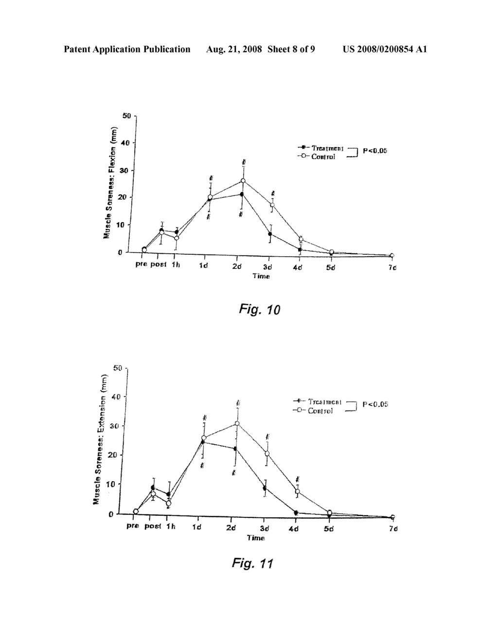 METHOD OF TREATING MUSCLE SORENESS OR A SOFT TISSUE OEDEMA - diagram, schematic, and image 09