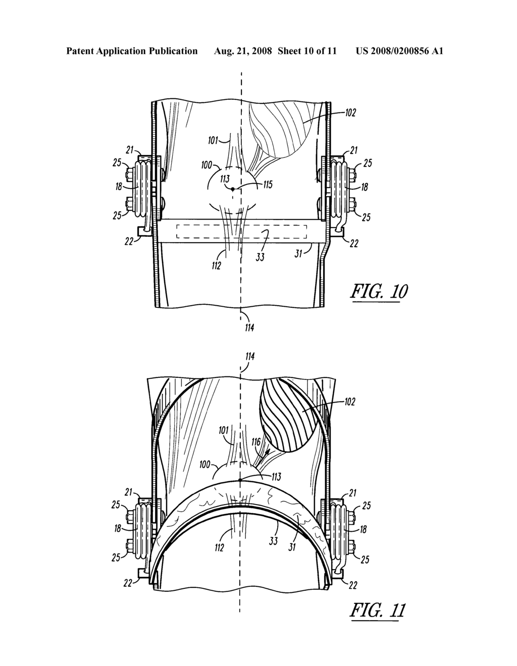 Method, apparatus, and system for bracing a knee - diagram, schematic, and image 11