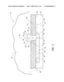 SYSTEM FOR TREATING OCULAR DISORDERS AND METHODS THEREOF diagram and image