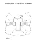 SYSTEM FOR TREATING OCULAR DISORDERS AND METHODS THEREOF diagram and image