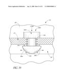 SYSTEM FOR TREATING OCULAR DISORDERS AND METHODS THEREOF diagram and image