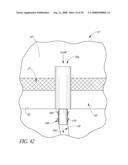 SYSTEM FOR TREATING OCULAR DISORDERS AND METHODS THEREOF diagram and image