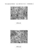 APPARATUS AND METHOD FOR SKIN TREATMENT diagram and image