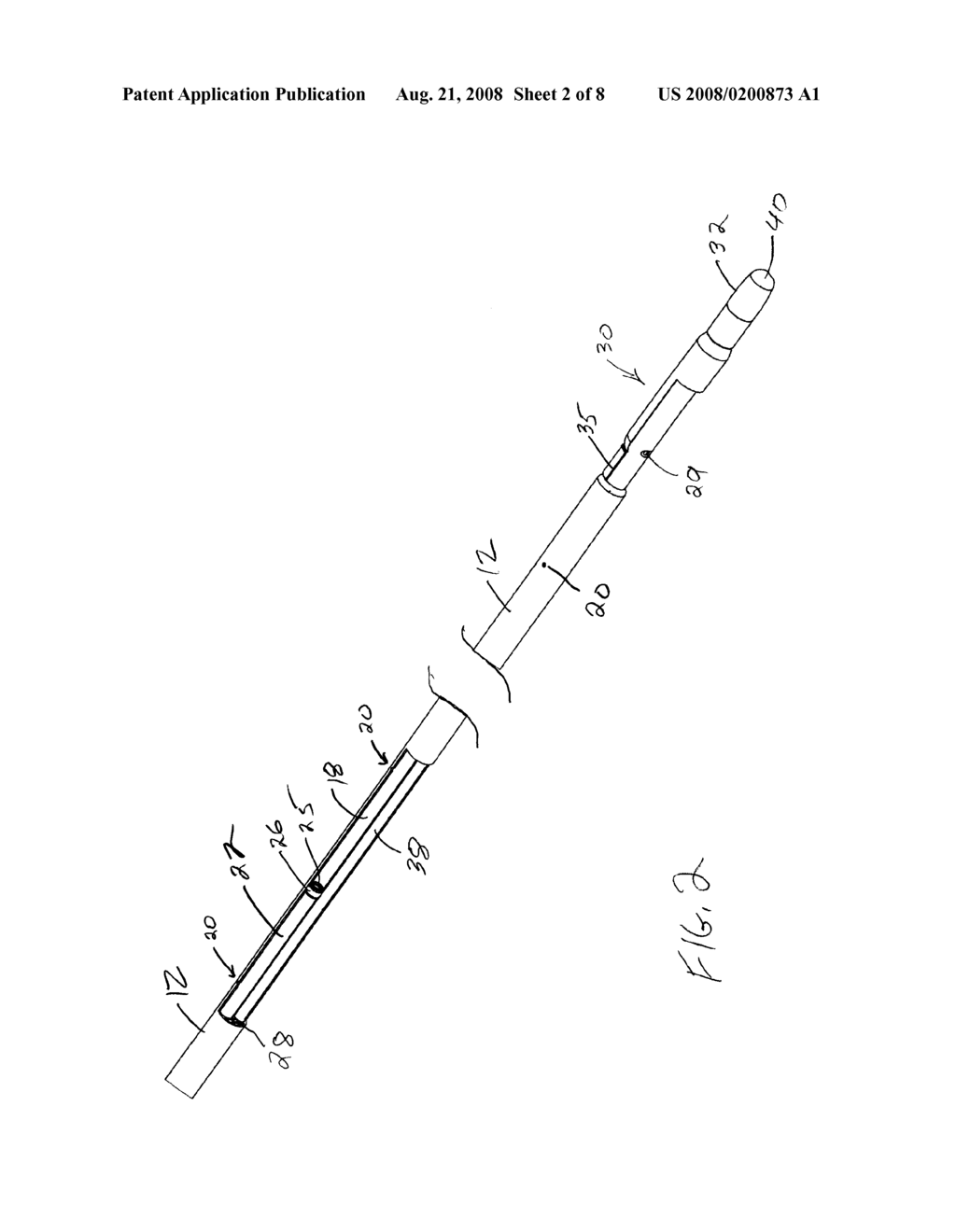 Methods and Apparatus for Infusing the Interior of a Blood Vessel - diagram, schematic, and image 03