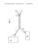 Fluid Exchange Catheter System diagram and image