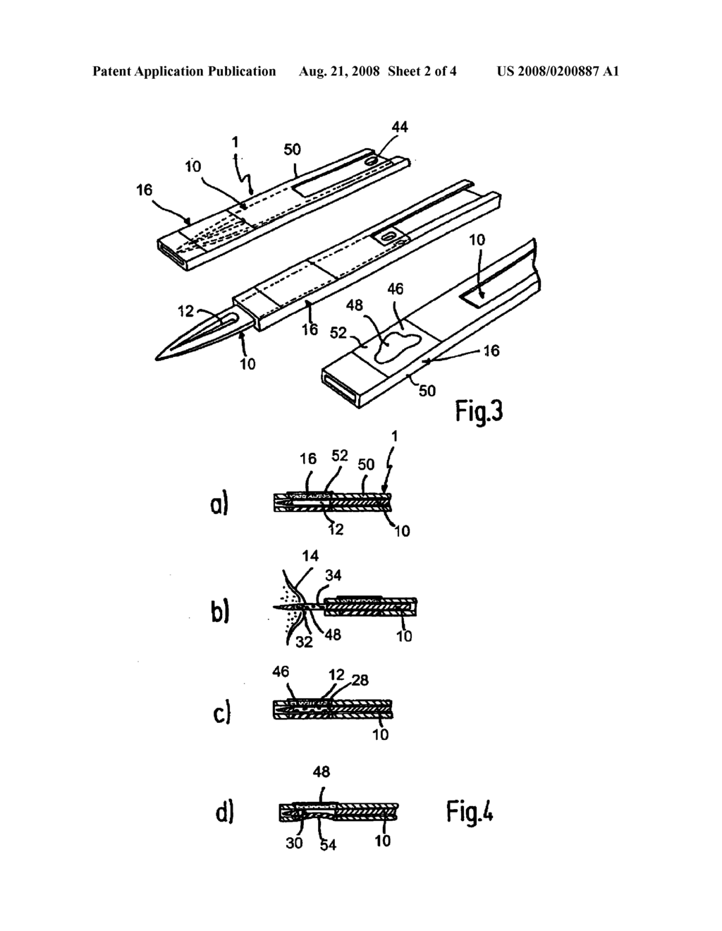 ASSEMBLY FOR RECEIVING BODY FLUIDS, AND METHOD FOR THE PRODUCTION THEREOF - diagram, schematic, and image 03