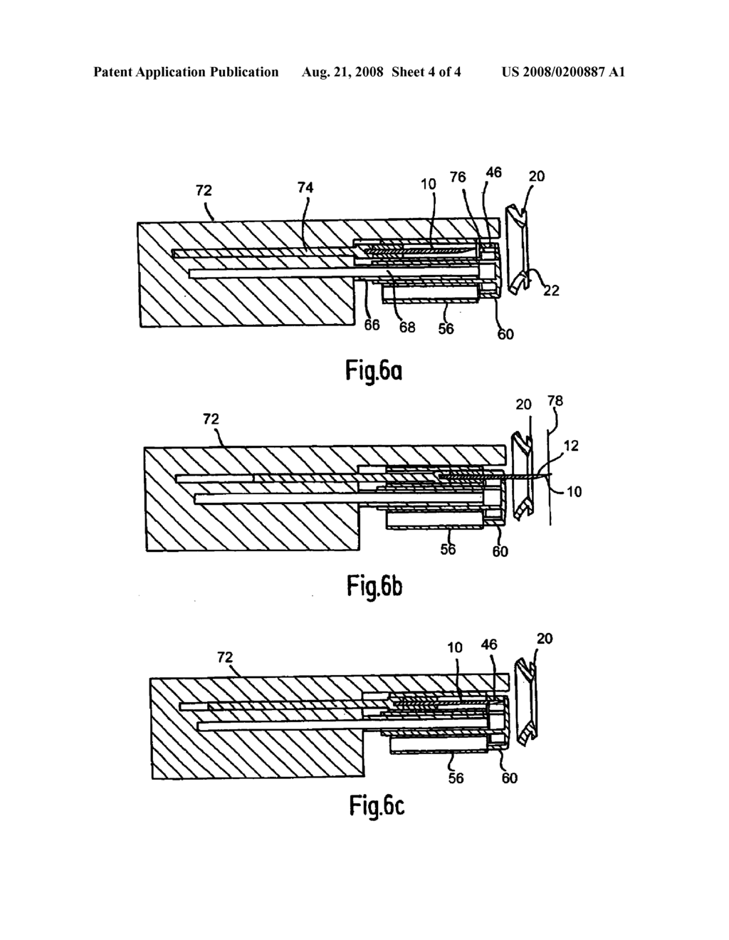 ASSEMBLY FOR RECEIVING BODY FLUIDS, AND METHOD FOR THE PRODUCTION THEREOF - diagram, schematic, and image 05