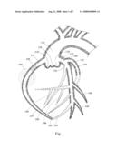 METHODS FOR INTRAVASCULAR ENGRAFTMENT IN HEART diagram and image