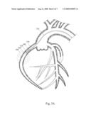 METHODS FOR INTRAVASCULAR ENGRAFTMENT IN HEART diagram and image