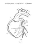 METHODS FOR INTRAVASCULAR ENGRAFTMENT IN HEART diagram and image