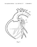 METHODS FOR INTRAVASCULAR ENGRAFTMENT IN HEART diagram and image