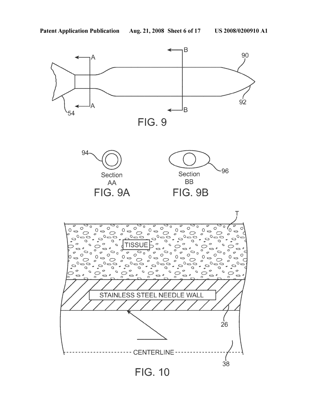 Replaceable and/or Easily Removable Needle Systems for Dermal and Transdermal Cryogenic Remodeling - diagram, schematic, and image 07