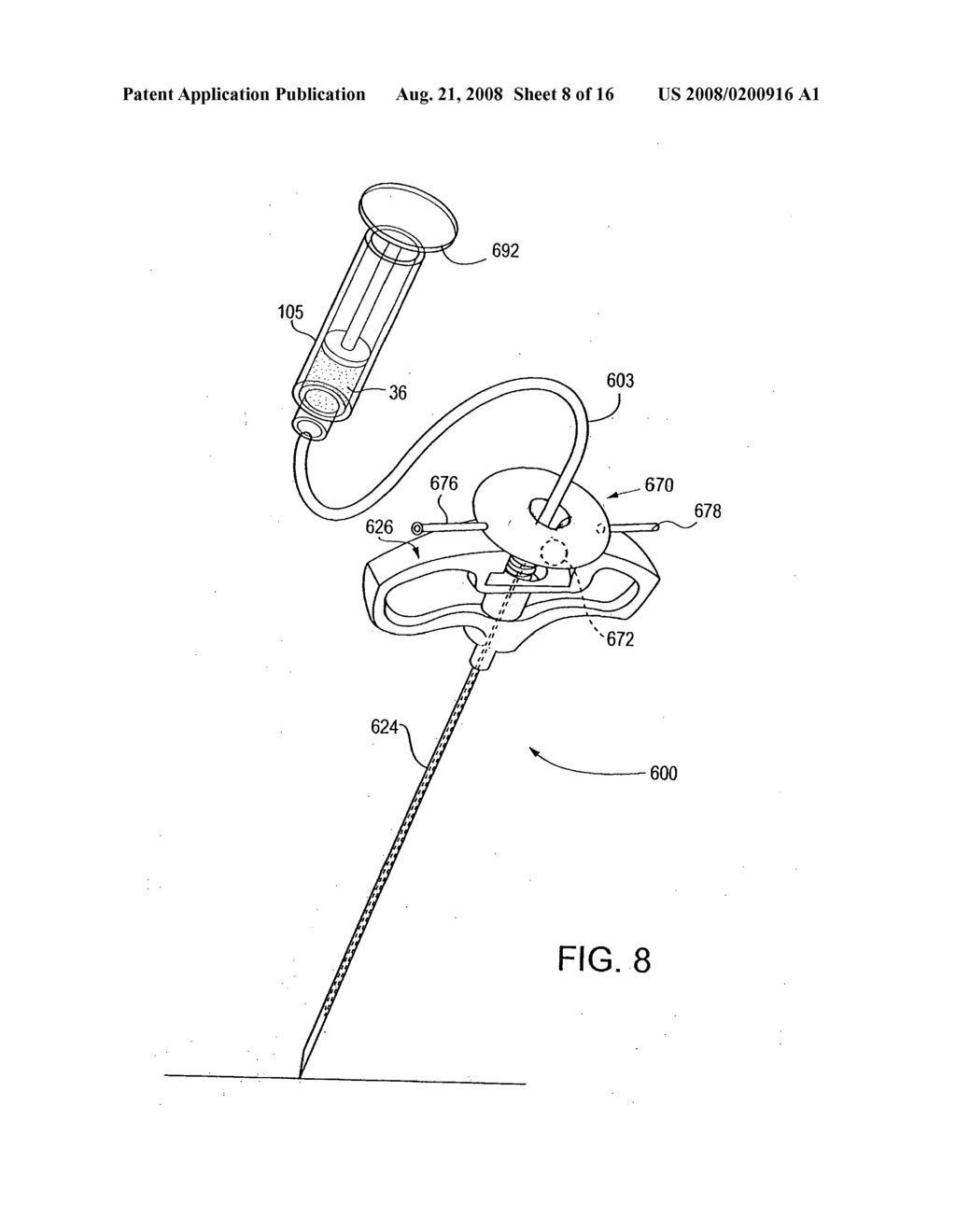 Cement Delivery Needle - diagram, schematic, and image 09