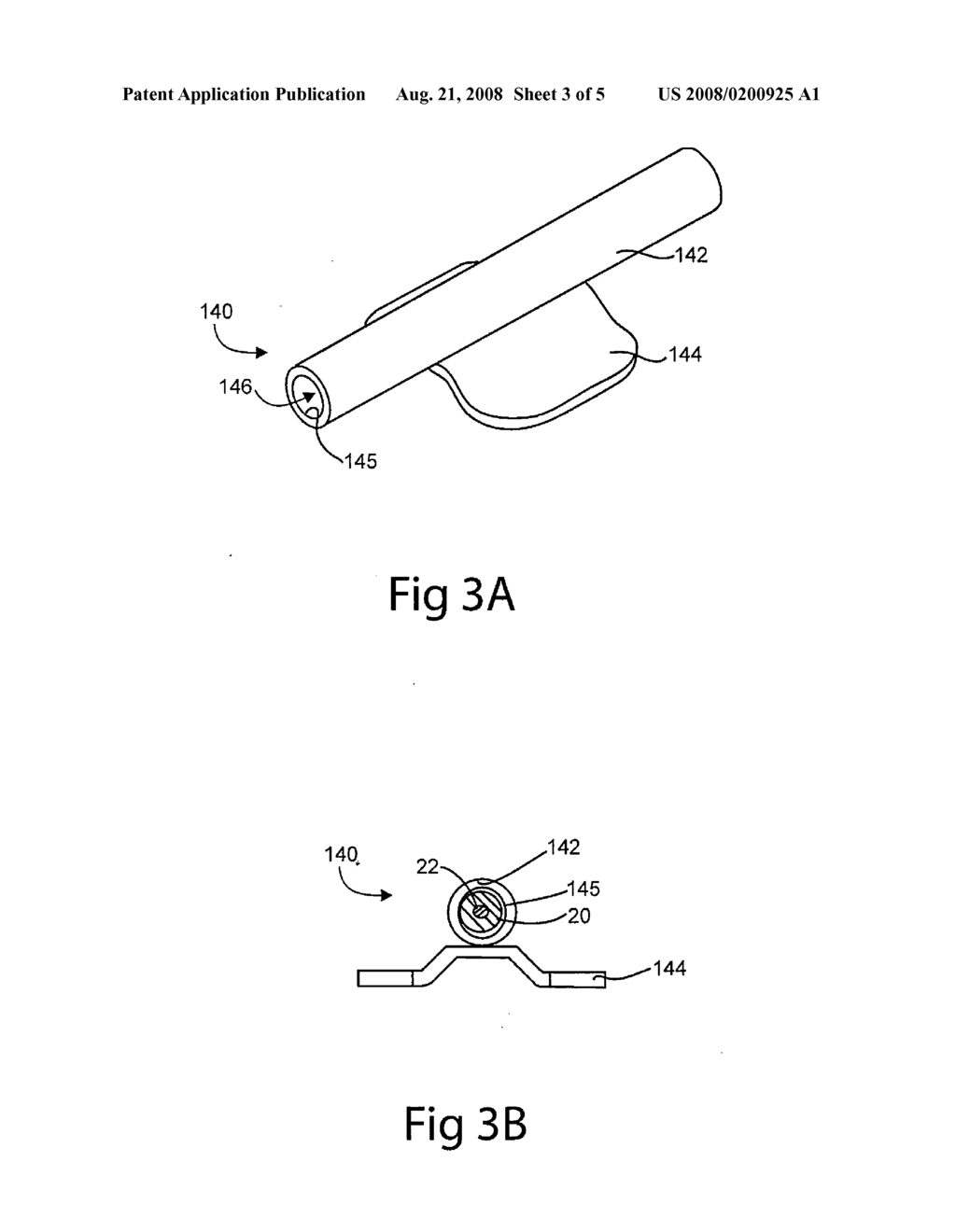 METHODS AND SYSTEMS FOR SECURING ELECTRODE LEADS - diagram, schematic, and image 04