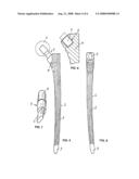 Metallic Bearings for Joint Replacement diagram and image