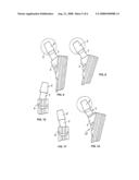 Metallic Bearings for Joint Replacement diagram and image