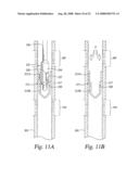 METHOD AND APPARATUS FOR EXPANDING AND SEPARATING TUBULARS IN A WELLBORE diagram and image