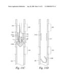 METHOD AND APPARATUS FOR EXPANDING AND SEPARATING TUBULARS IN A WELLBORE diagram and image