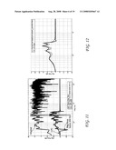 Room acoustic response modeling and equalization with linear predictive coding and parametric filters diagram and image