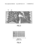 Apparatus and Method for Providing 2D Representation of 3D Image Data Representing an Anatomical Lumen Tree Structure diagram and image