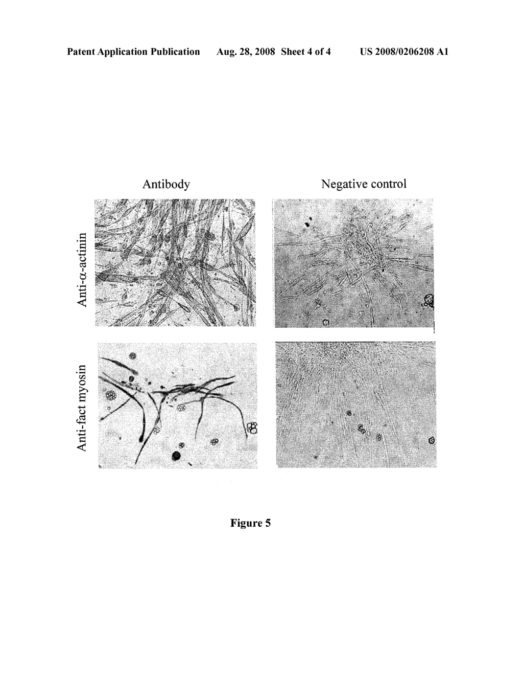 EXTRAMEDULLARY ADIPOSE TISSUE CELLS AND USE THEREOF FOR REGENERATING HEMATOPOIETIC AND MUSCULAR TISSUES - diagram, schematic, and image 05