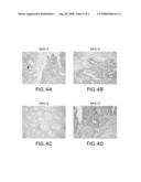 Tumor-associated Peptides Binding Promiscuously to Human Leukocyte Antigen (HLA) Class II Molecules diagram and image