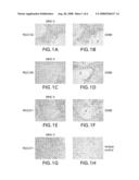 Tumor-associated Peptides Binding Promiscuously to Human Leukocyte Antigen (HLA) Class II Molecules diagram and image