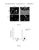 Treatments for cancer diagram and image