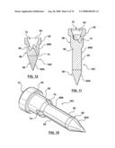 Composite Nozzle Tip Method diagram and image