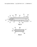 Composite Nozzle Tip Method diagram and image