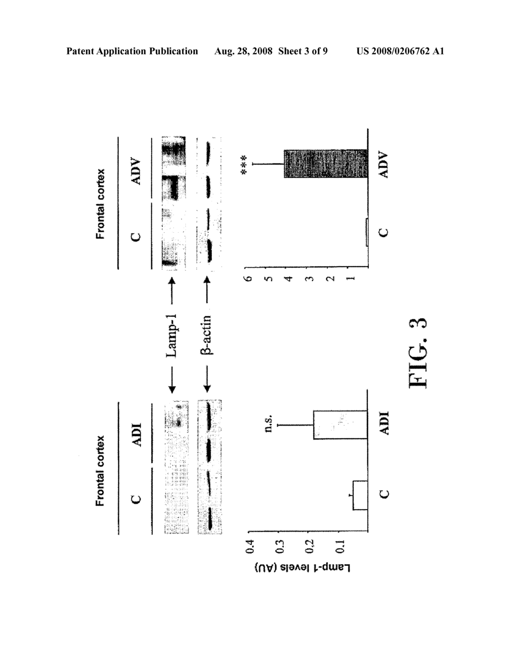 Method for the Diagnosis of Alzeimer's Disease - diagram, schematic, and image 04