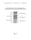 COMPOSITIONS AND METHODS FOR THE THERAPY AND DIAGNOSIS OF BREAST CANCER diagram and image