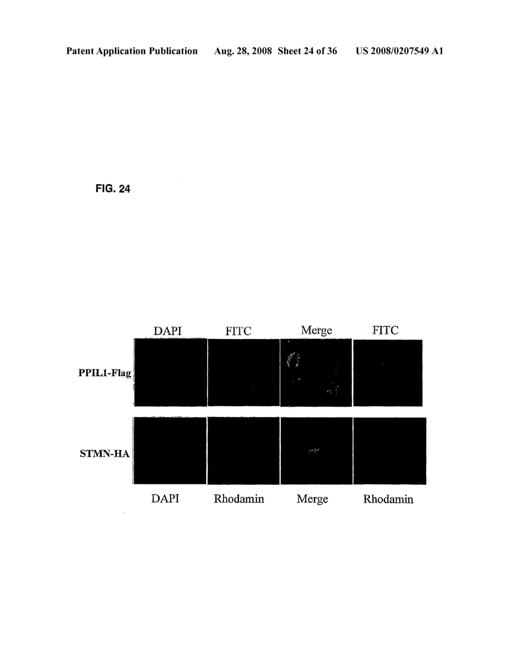 GENES AND POLYPEPTIDES RELATING TO HEPATOCELLULAR OR COLORECTAL CARCINOMA - diagram, schematic, and image 25