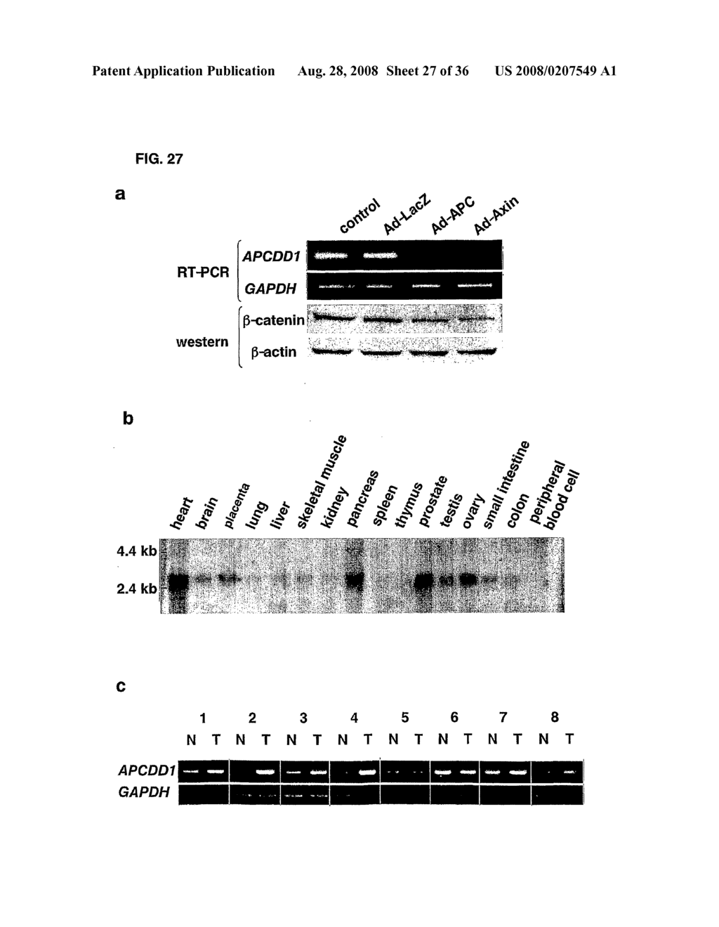 GENES AND POLYPEPTIDES RELATING TO HEPATOCELLULAR OR COLORECTAL CARCINOMA - diagram, schematic, and image 28